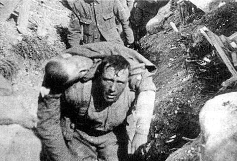 World War I casualty.